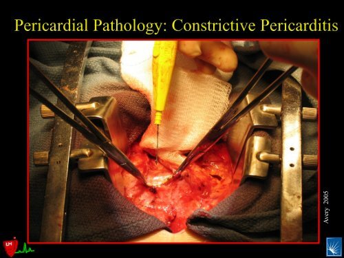 Pericardial Pathology - Casecag.com