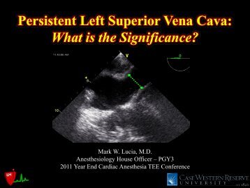 Persistent Left Superior Vena Cava: What is the ... - Casecag.com