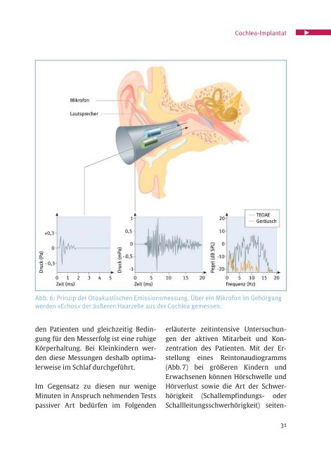 Cochlea - Med-El