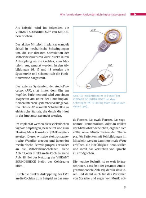 Cochlea - Med-El