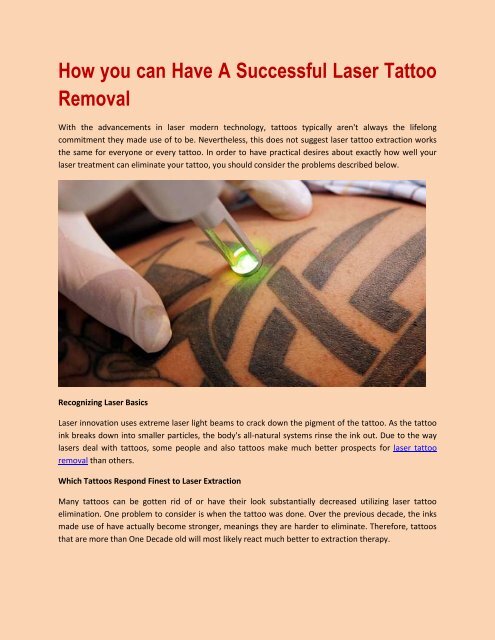 How you can Have A Successful Laser Tattoo Removal