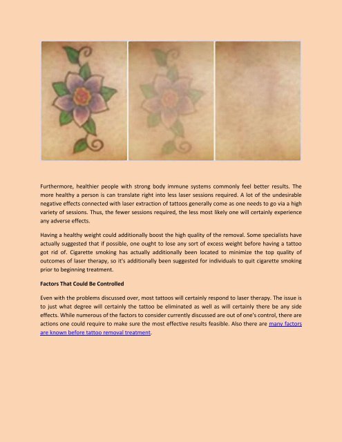 How you can Have A Successful Laser Tattoo Removal