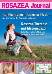 Rosazea-Therapie mit metronidazol »In harmonie mit meiner haut«