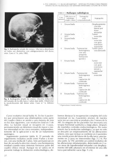 (pdf primer nÃºmero). - Sociedad EspaÃ±ola de NeurologÃ­a