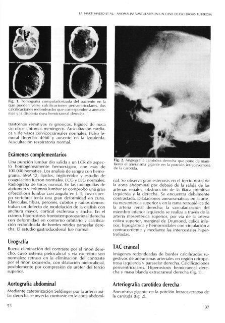 (pdf primer nÃºmero). - Sociedad EspaÃ±ola de NeurologÃ­a