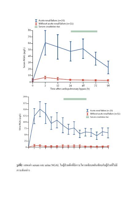 Pediatric acute renal failure