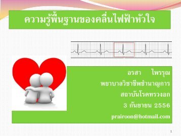 คลื่นไฟฟ้าหัวใจ 3 กย 56 อ.อรสา