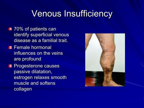 Venous Disease