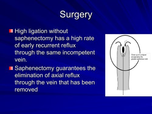 Venous Disease