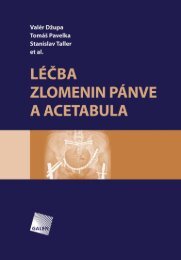 LÃ©Äba zlomenin pÃ¡nve a acetabula - Databook.cz