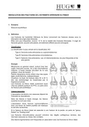 RÃ©Ã©ducation des fractures de l'extrÃªmitÃ© infÃ©rieure du fÃ©mur