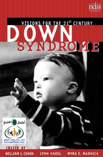 Down Syndrome
