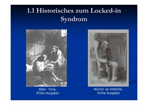 1.1 Historisches zum Locked-in Syndrom - LIS · Locked-In-Syndrom ...