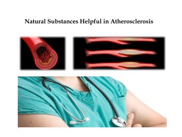 Natural Substances Helpful in Atherosclerosis