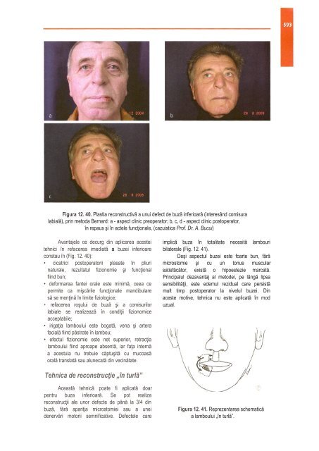 Compendiu-de-chirurgie-OMF-Prof-Bucur-Vol-II.pdf