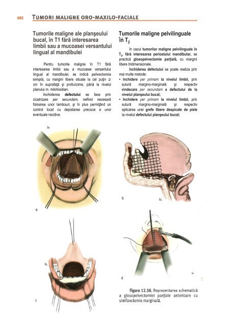 Compendiu-de-chirurgie-OMF-Prof-Bucur-Vol-II.pdf