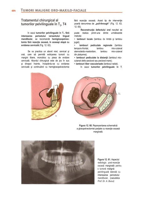 Compendiu-de-chirurgie-OMF-Prof-Bucur-Vol-II.pdf