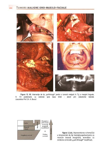 Compendiu-de-chirurgie-OMF-Prof-Bucur-Vol-II.pdf