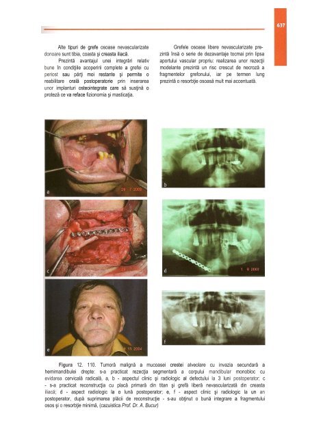 Compendiu-de-chirurgie-OMF-Prof-Bucur-Vol-II.pdf