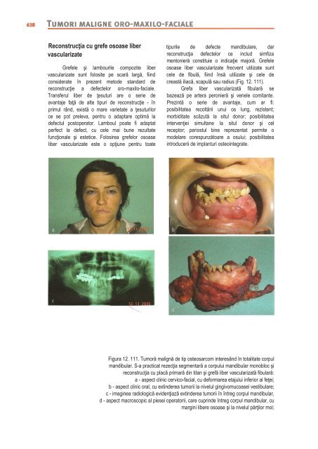 Compendiu-de-chirurgie-OMF-Prof-Bucur-Vol-II.pdf