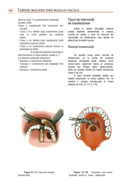 Compendiu-de-chirurgie-OMF-Prof-Bucur-Vol-II.pdf