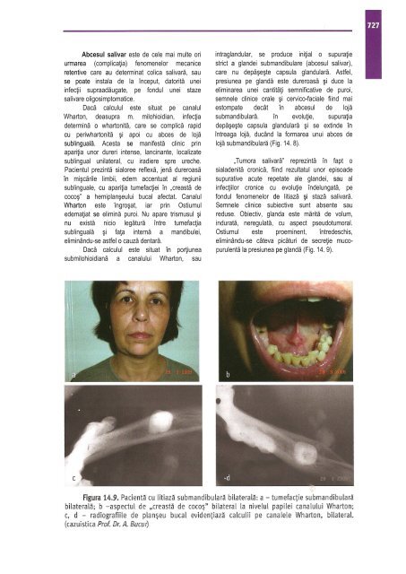 Compendiu-de-chirurgie-OMF-Prof-Bucur-Vol-II.pdf