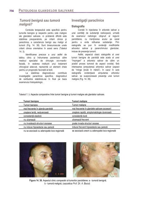 Compendiu-de-chirurgie-OMF-Prof-Bucur-Vol-II.pdf