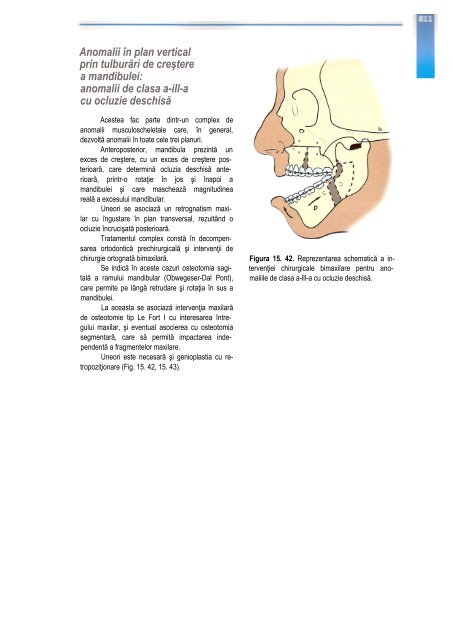 Compendiu-de-chirurgie-OMF-Prof-Bucur-Vol-II.pdf