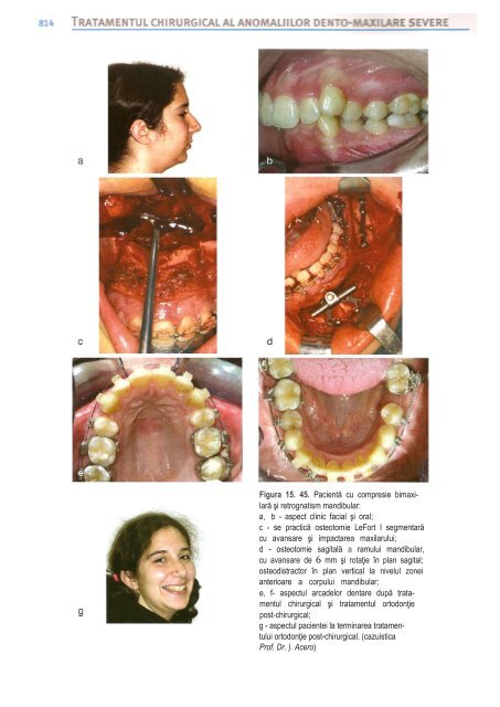 Compendiu-de-chirurgie-OMF-Prof-Bucur-Vol-II.pdf