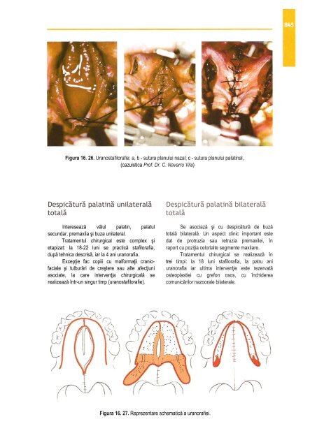 Compendiu-de-chirurgie-OMF-Prof-Bucur-Vol-II.pdf