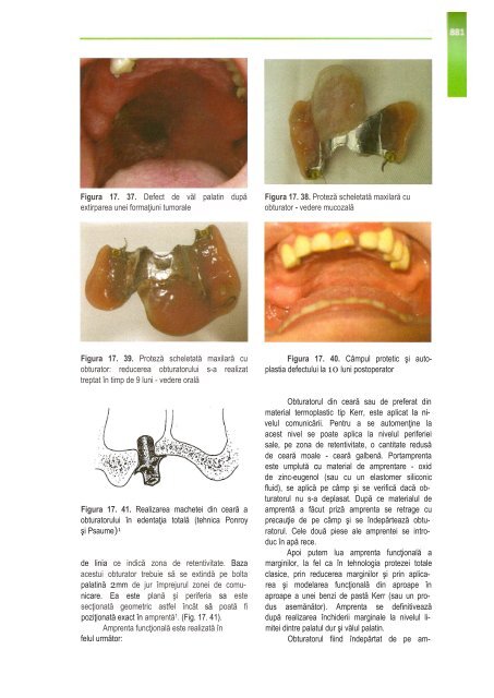 Compendiu-de-chirurgie-OMF-Prof-Bucur-Vol-II.pdf