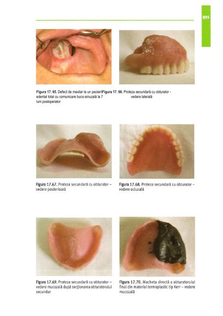 Compendiu-de-chirurgie-OMF-Prof-Bucur-Vol-II.pdf