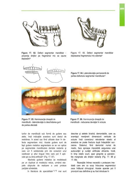 Compendiu-de-chirurgie-OMF-Prof-Bucur-Vol-II.pdf