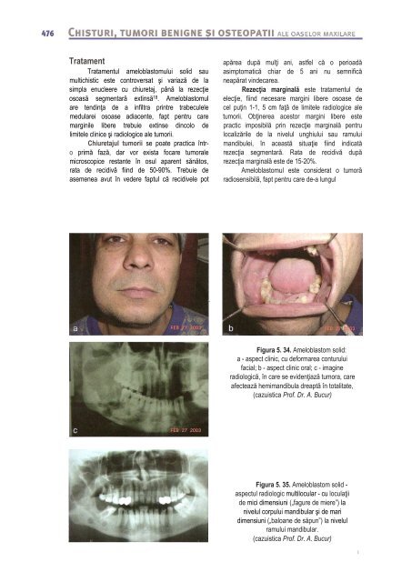 Compendiu-de-chirurgie-OMF-Prof-Bucur-Vol-II.pdf