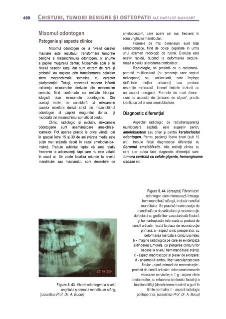 Compendiu-de-chirurgie-OMF-Prof-Bucur-Vol-II.pdf