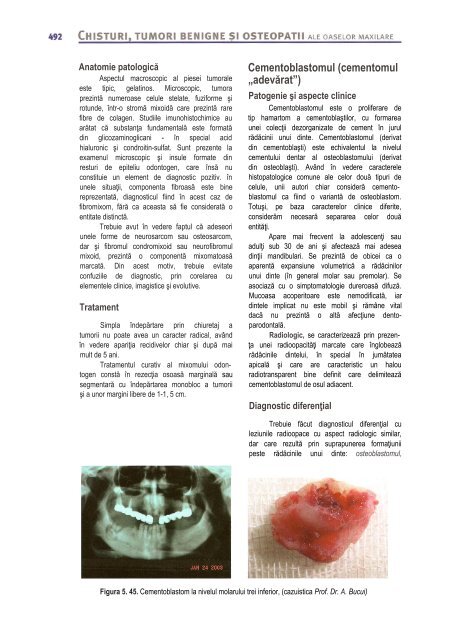 Compendiu-de-chirurgie-OMF-Prof-Bucur-Vol-II.pdf