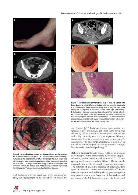 Download - World Journal of Gastroenterology