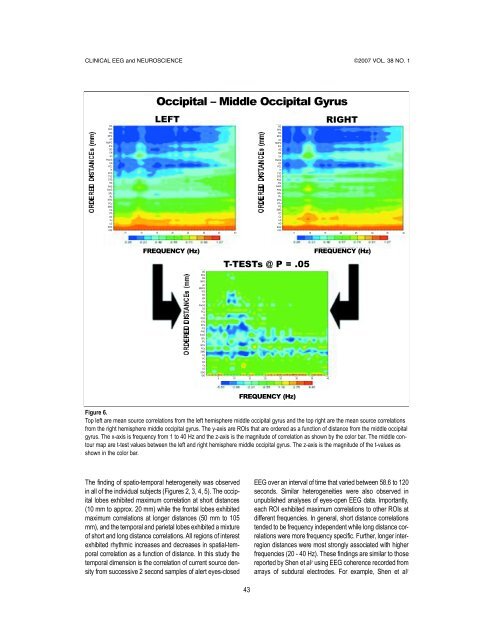 CLINICAL EEG and NEUROSCIENCE - Dynamic Memory Lab