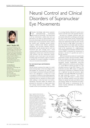 Neural Control and Clinical Disorders of Supranuclear Eye ...