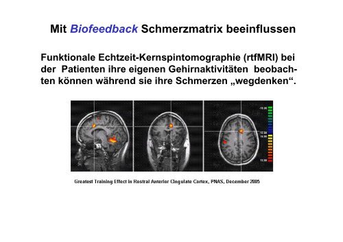 Definition: Schmerz ist ein unangenehmes Sinnes- und ...