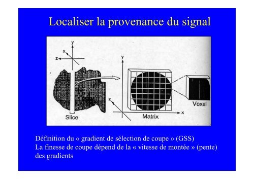 Bases de l'IRM en cardiologie - CHU de Rouen