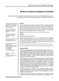 SÃ­ndrome Doloroso Regional Complejo ART Ã CULOESPECIAL