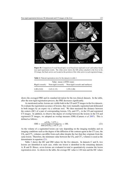 Non-rigid registration between 3D ultrasound and CT ... - isl, ee, kaist