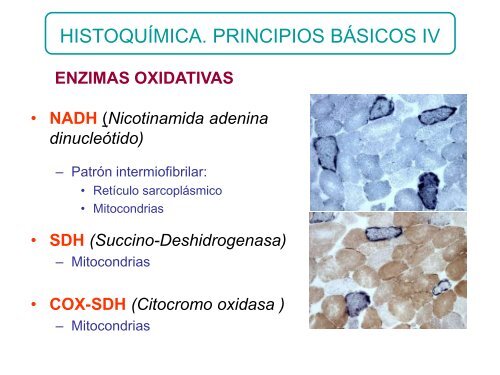 TÃ¨cnicas de histoquimica ,IHQ y utilidad diagnostica en patologÃ­a ...