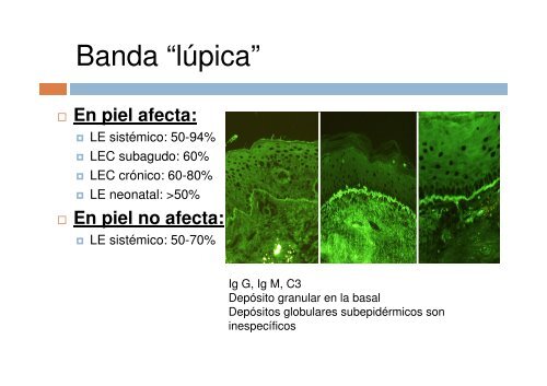 Dermatitis de interfase vacuolar