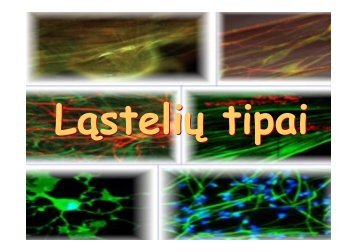 LÄsteliÅ³ tipai