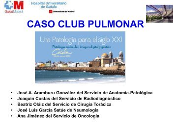 CASO CLUB PULMONAR CONGRESO NACIONAL CADIZ 2013