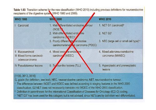 Neuroendocrine Tumors of the Pancreas