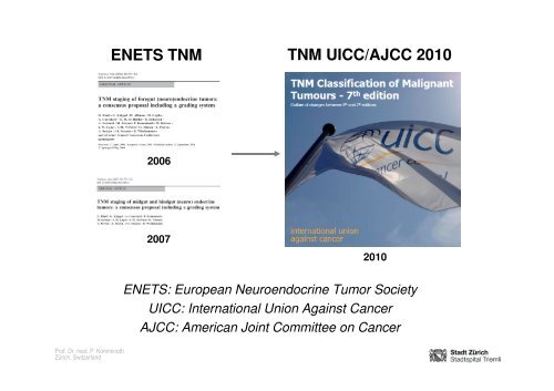 Neuroendocrine Tumors of the Pancreas