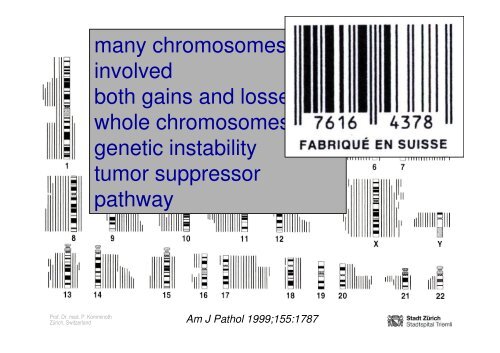 Neuroendocrine Tumors of the Pancreas